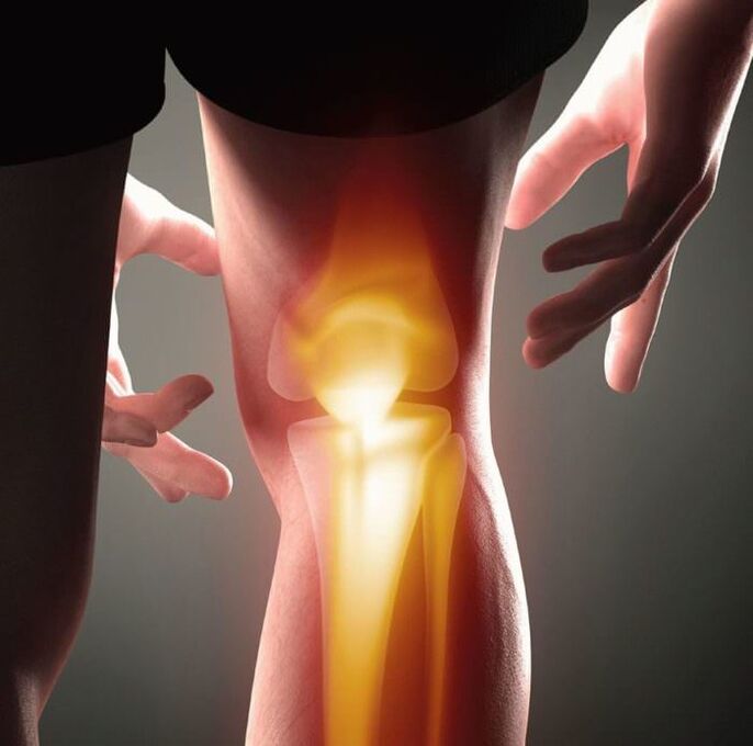 Qu'est-ce que l'arthrite et l'arthrose